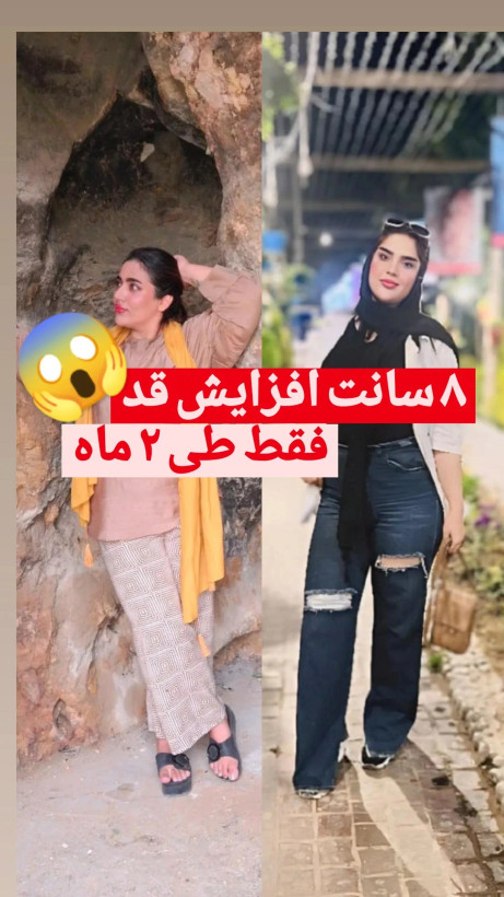 افزایش قد طبیعی و اصولی بدون محدودیت سنی